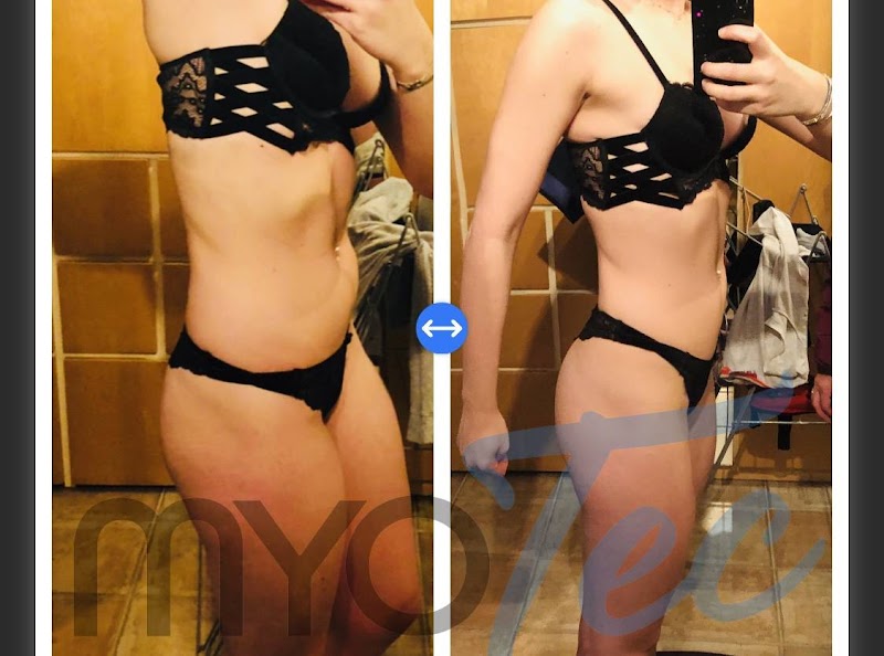 MyoTec Aix-en-Provence | Miha Bodytec